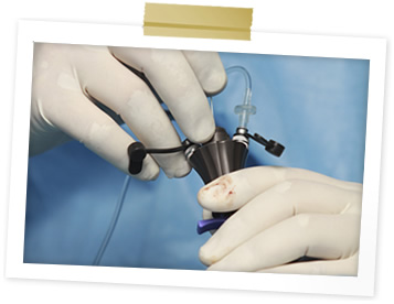 Laparoscopic Spay